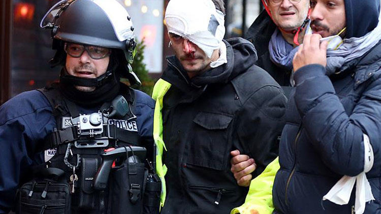 AB’ye ‘çifte standart’ suçlaması