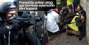 Fransız polisi eylemcinin elini kopardı