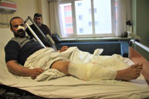 Köpekler burnunu ve bacağını parçaladı