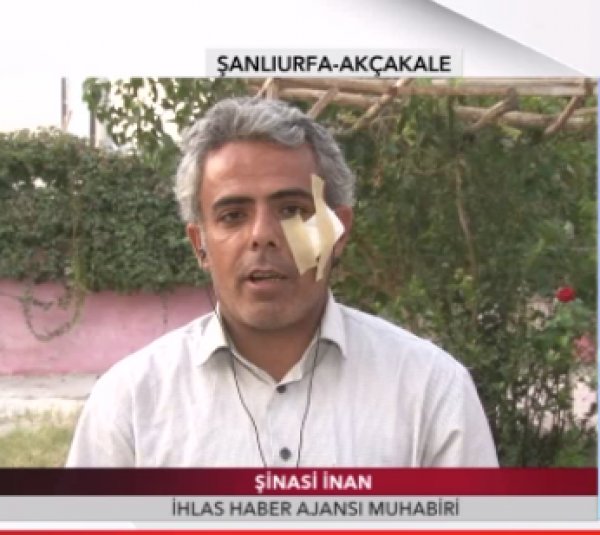 İHA muhabiri Şinasi İnan şarapnel parçasıyla yaralandı