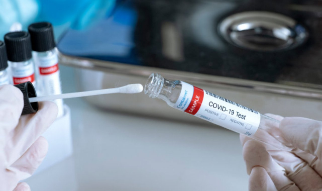 COVID-19’un yeni varyantı ABD ve Avrupa’da en az 17 kişide görüldü