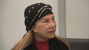 81 yaşında estetik yaptıran Bedia Akartürk’ten açıklama