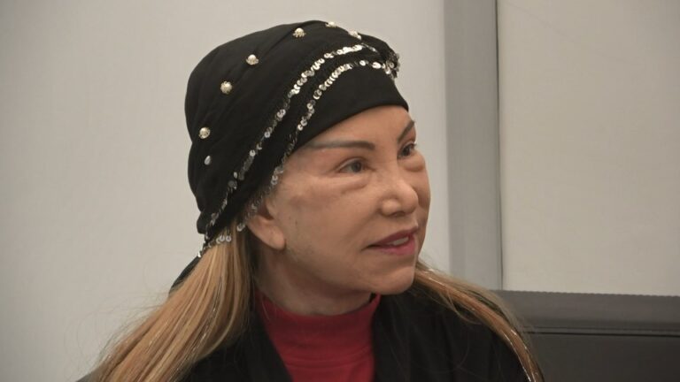 81 yaşında estetik yaptıran Bedia Akartürk’ten açıklama